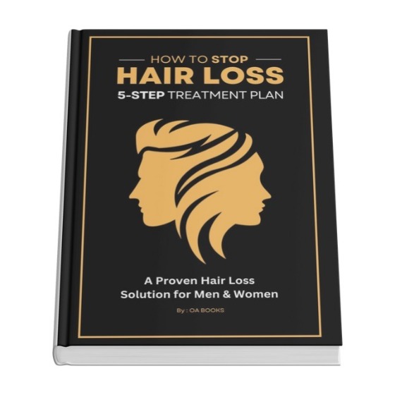 Treating Hair Loss The Complete Guide book cover for men and women with thinning hair
