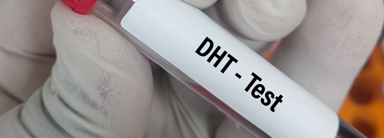 DHT suppression and male pattern hair loss